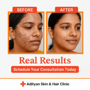 Read more about the article Discover the Best Skin Care Clinic in Chennai – Your Journey to Radiant Skin Starts at Adityan